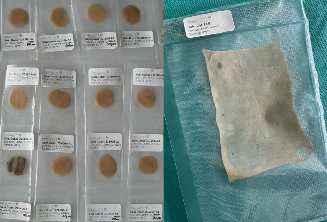 破解“人皮令”合规困局丨suncity太阳新城生物重磅推出人源离体皮肤组织解决方案(图2)